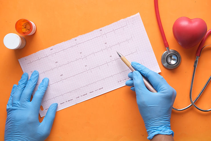 ekg, zburzenia rytmu serca, ból serca
